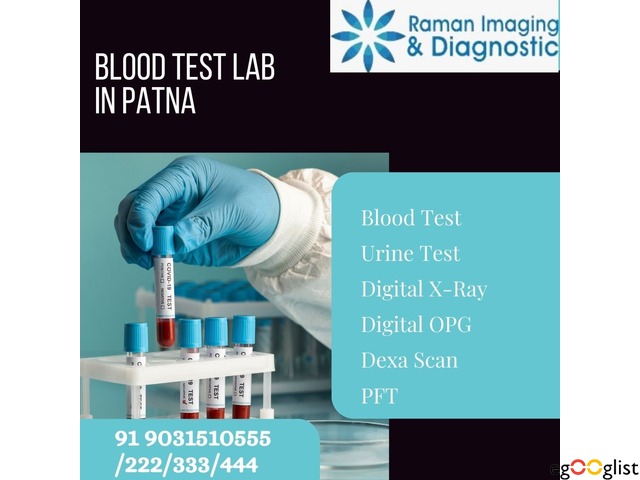 Raman Imaging and Diagnostic Centre: Your Trusted Blood Test Lab in Patna