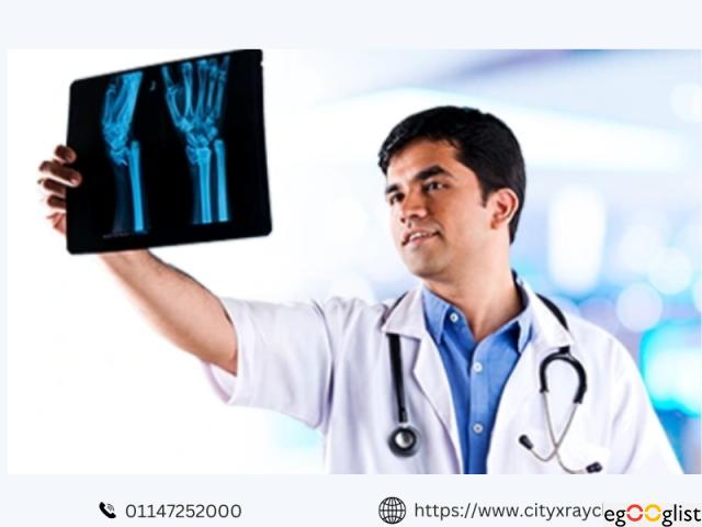 Know the Latest X Ray Price Near You Quick Cost Guide